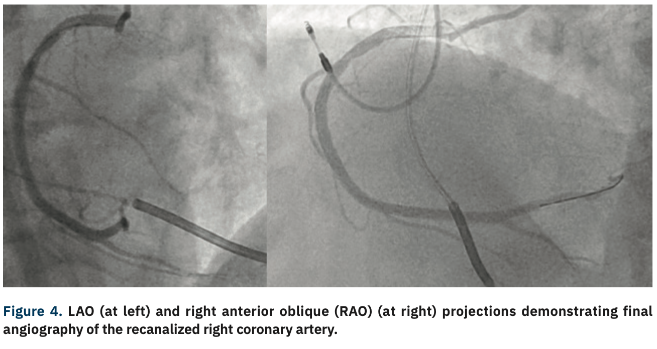 Gurevich CTO Figure 4
