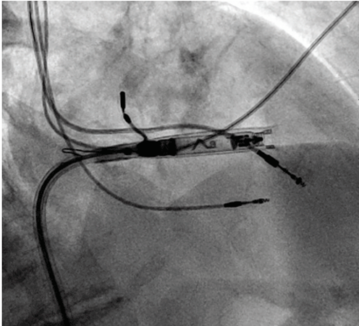 Hadadi - Fig 2 - Nov 2024 