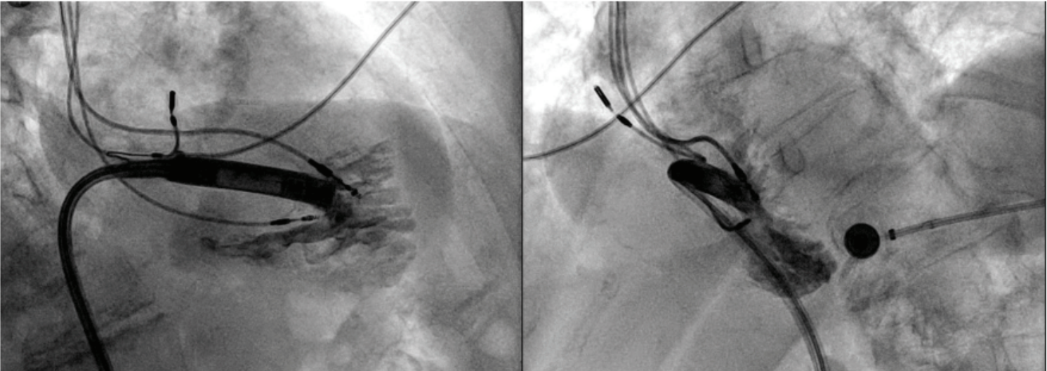 Hadadi - Fig 3 - Nov 2024 