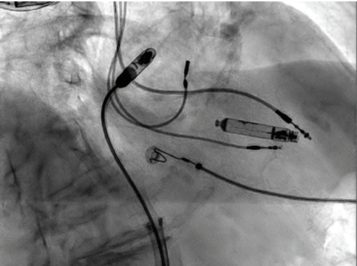 Hadadi - Fig 5 - Nov 2024 