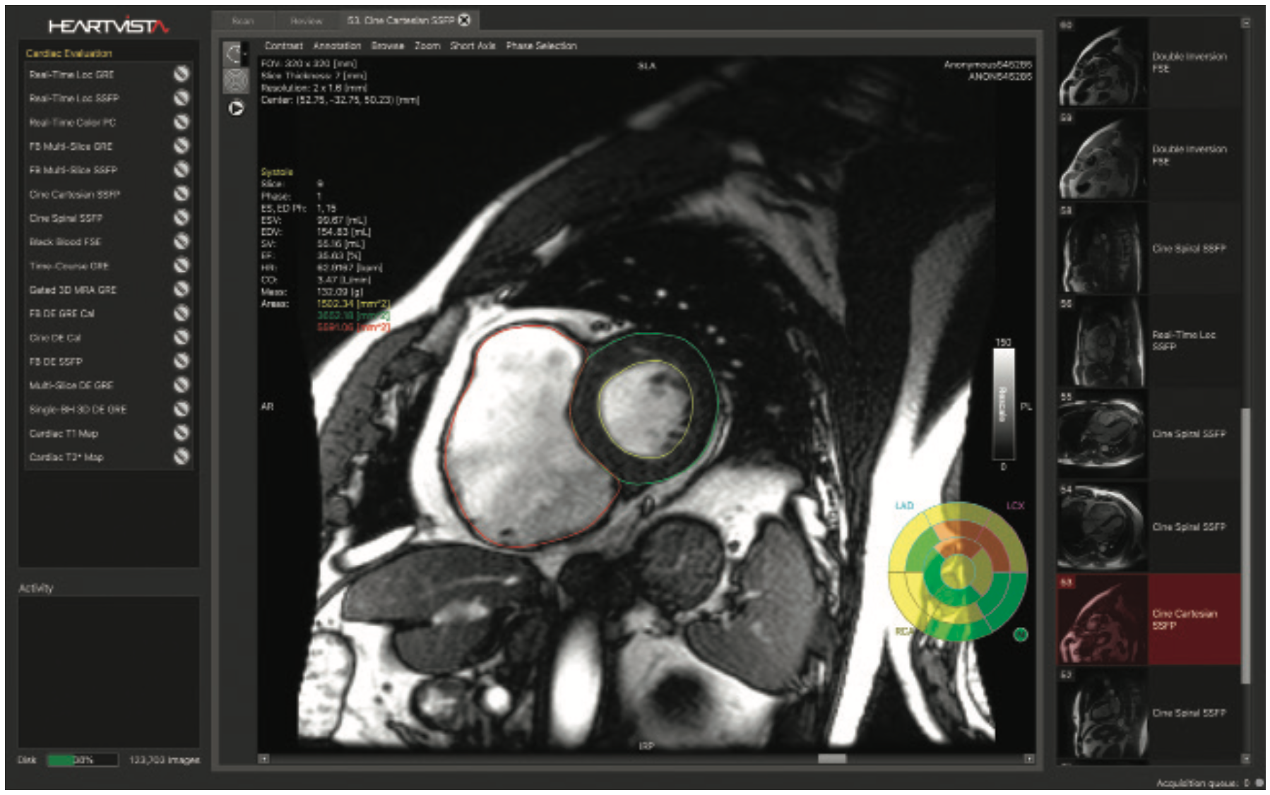 HeartVista Diagnostic Figure 1