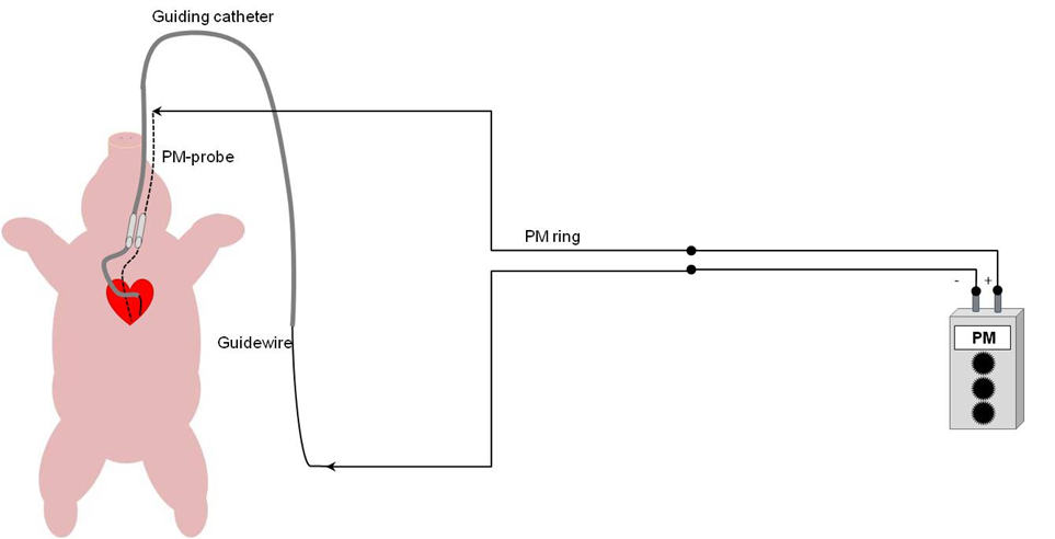 Figure 2. In vivo model: transcoronary pacing setup. 