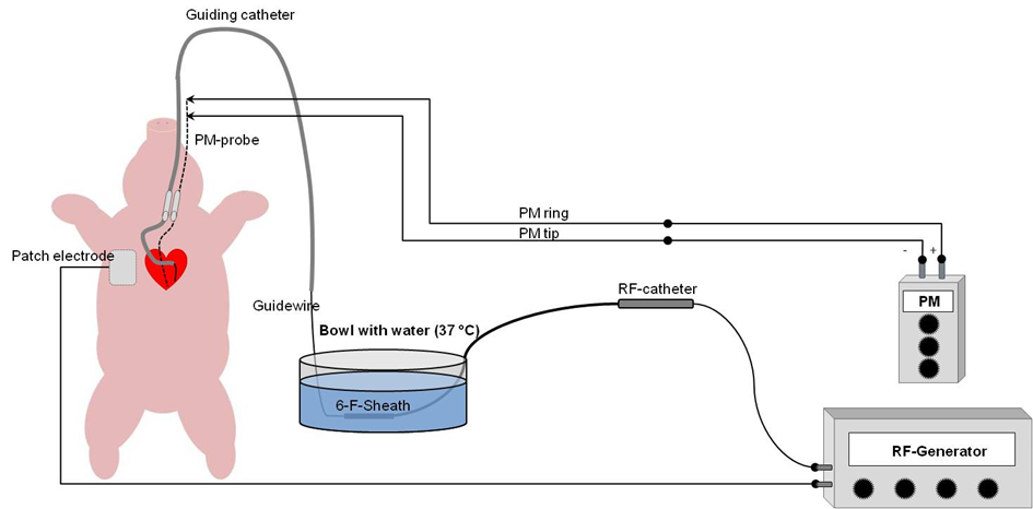 Figure 3. In vivo model: transcoronary radiofrequency-ablation setup. 