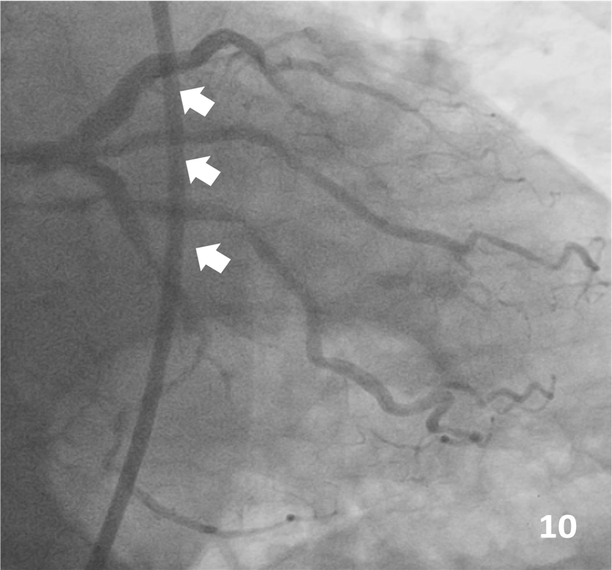 Figure 10. Final result
