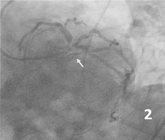Figure 2. Spider view 