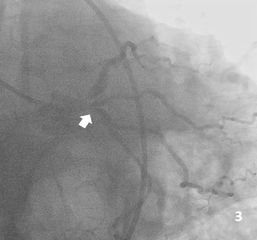 Figure 3. Antero-posterior caudal view