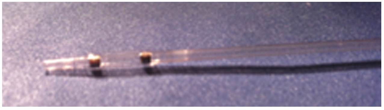 Heuser Fem-Pop Graft Failure Figure 2
