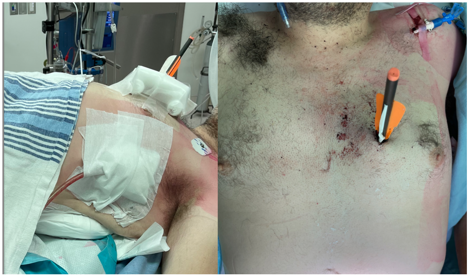 Hibino Heart Figure 1