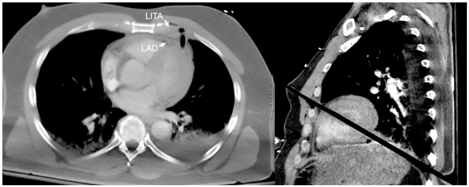 Hibino Heart Figure 2