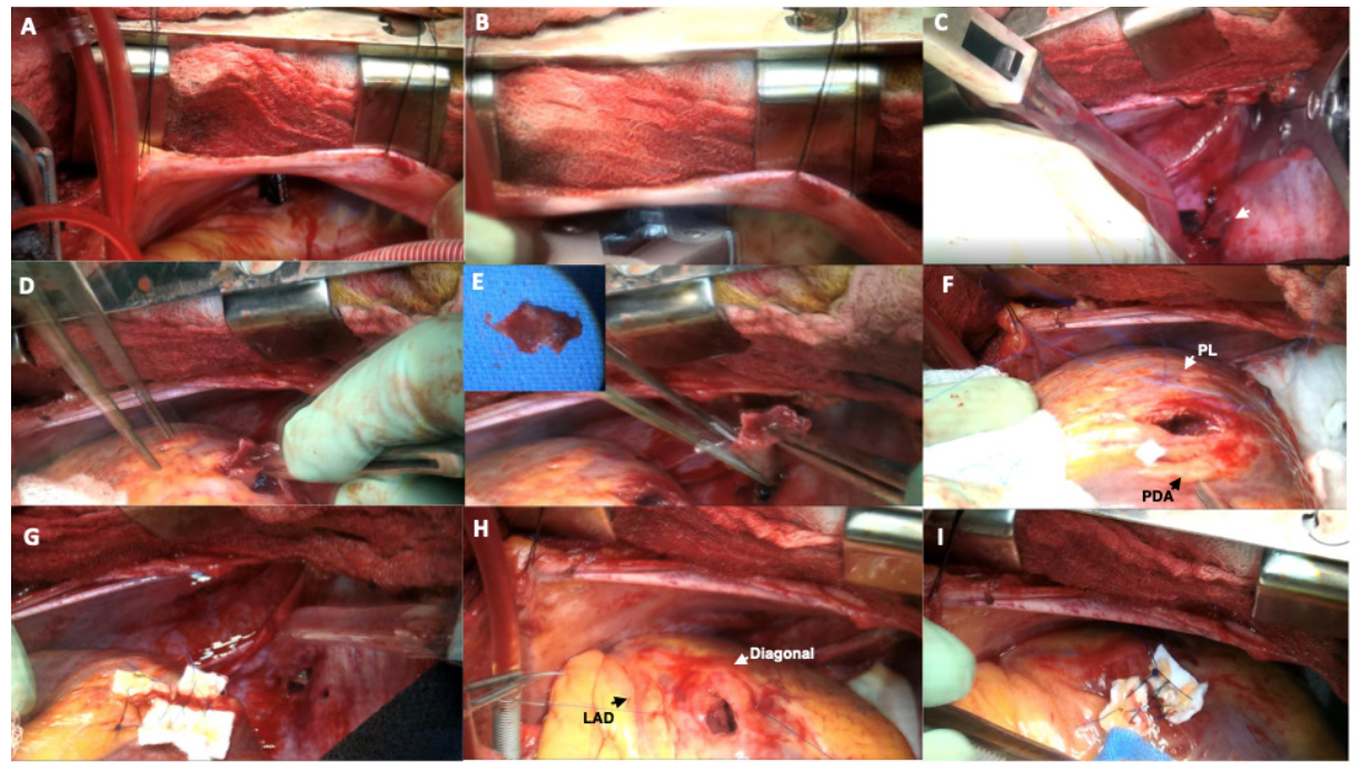 Hibino Heart Figure 3