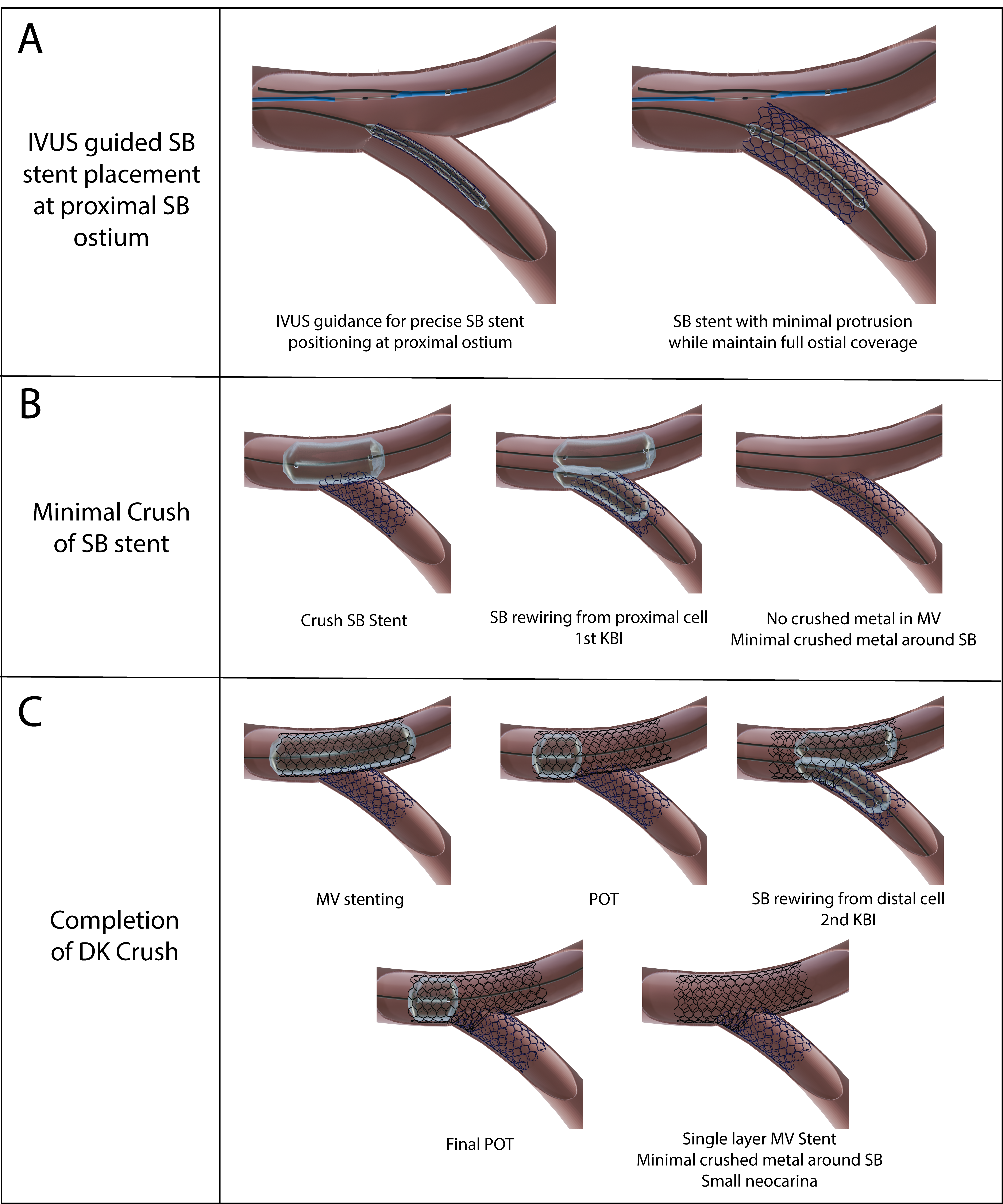 Figure 2. Illustrative steps of IM-CRUSH. 