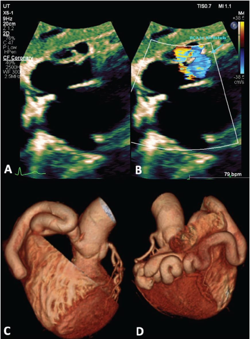 Holtzapple Fig 1 May 2024