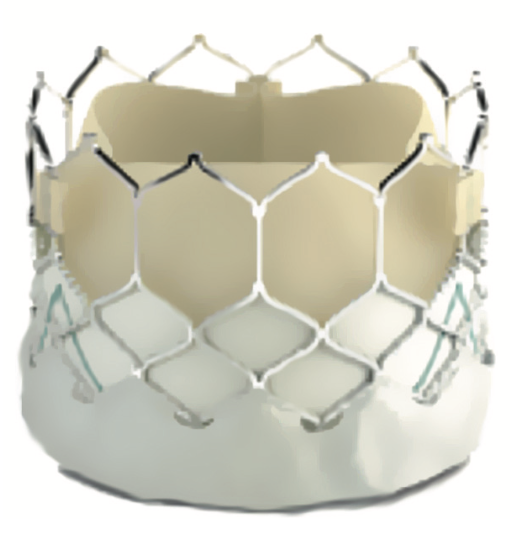 IAGS Greenbaum 5.2 TMVR Figure 2