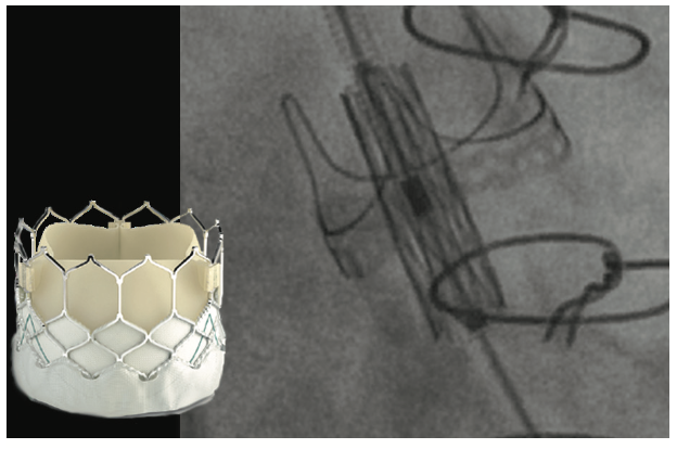 IAGS Greenbaum 6.3 Fusion Imaging Figure 1