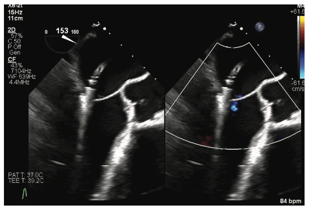 IAGS Greenbaum 6.3 Fusion Imaging Figure 2