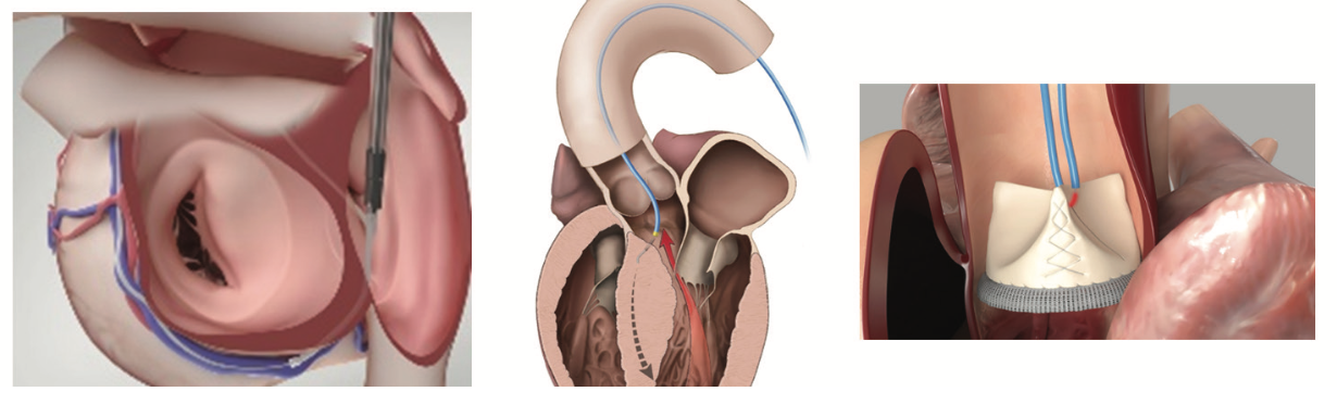 IAGS Greenbaum 6.3 Fusion Imaging Figure 3