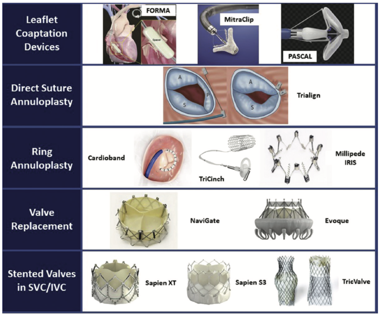 IAGS O’Neill 5.3 Tricuspid Figure 2