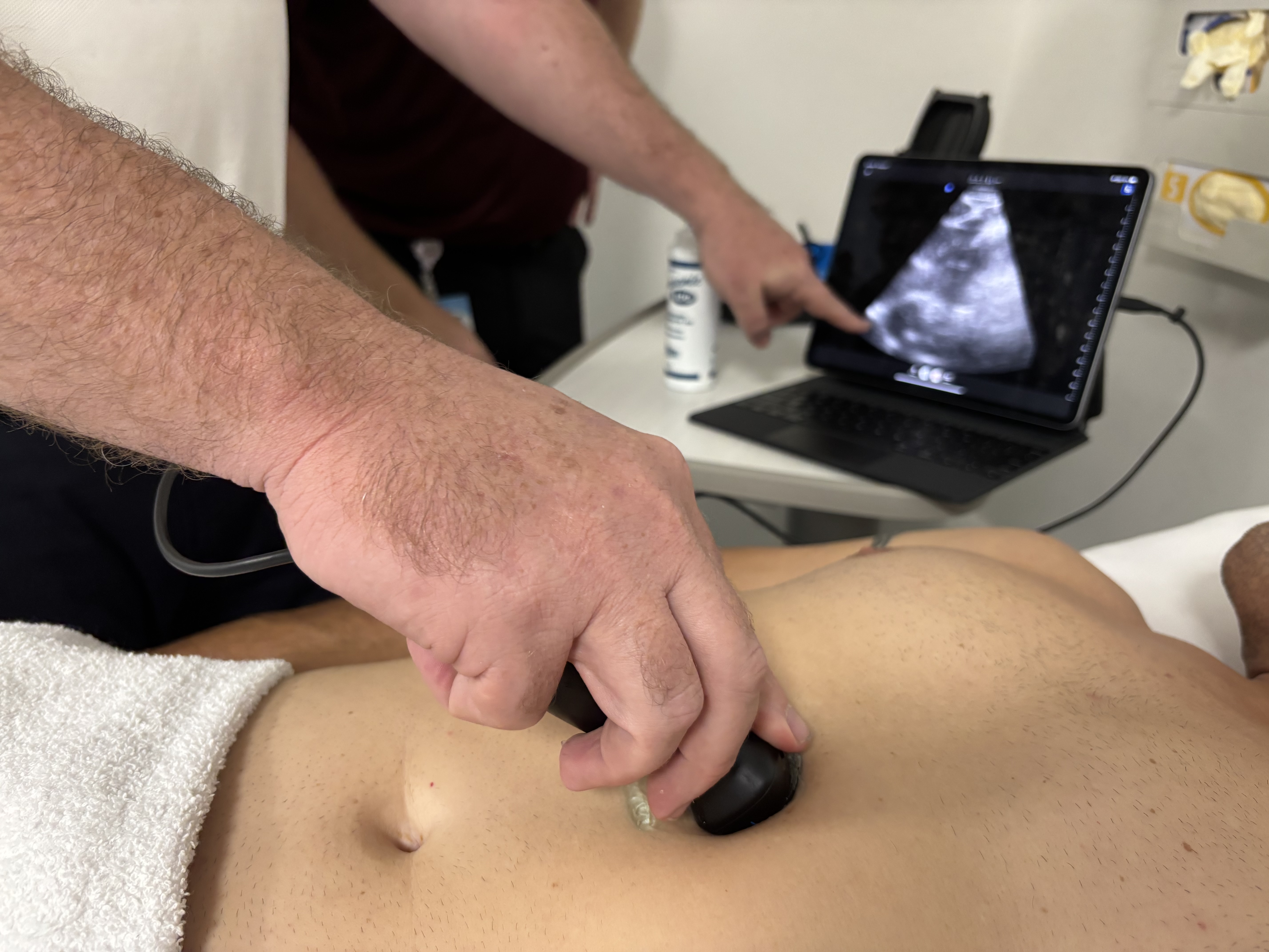 point of care ultrasound