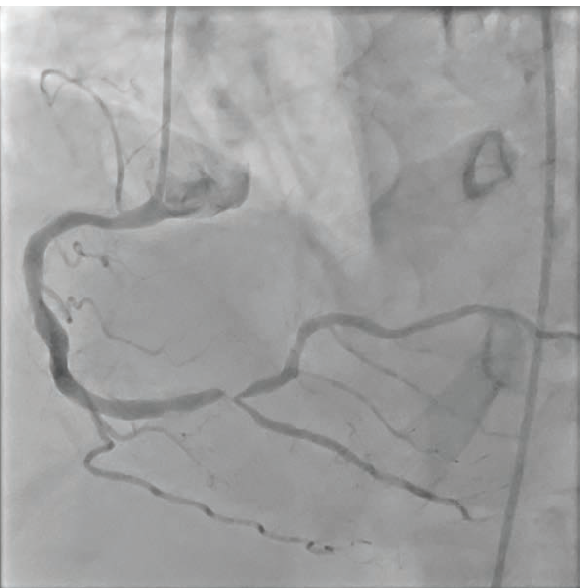 Imaging Corner - Fig 1 - October 2024