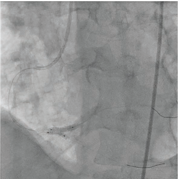 Imaging Corner - Fig 2 - October 2024