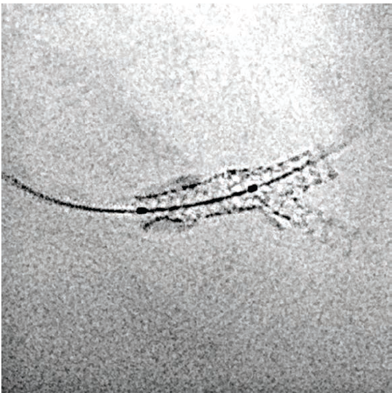 Imaging Corner - Fig 3 - October 2024