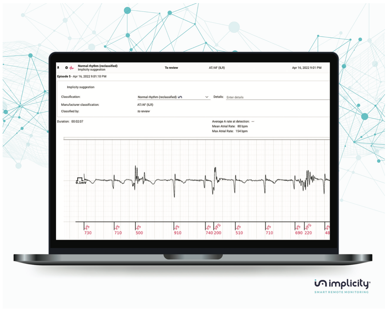 Implicity Artificial Intelligence Figure 1