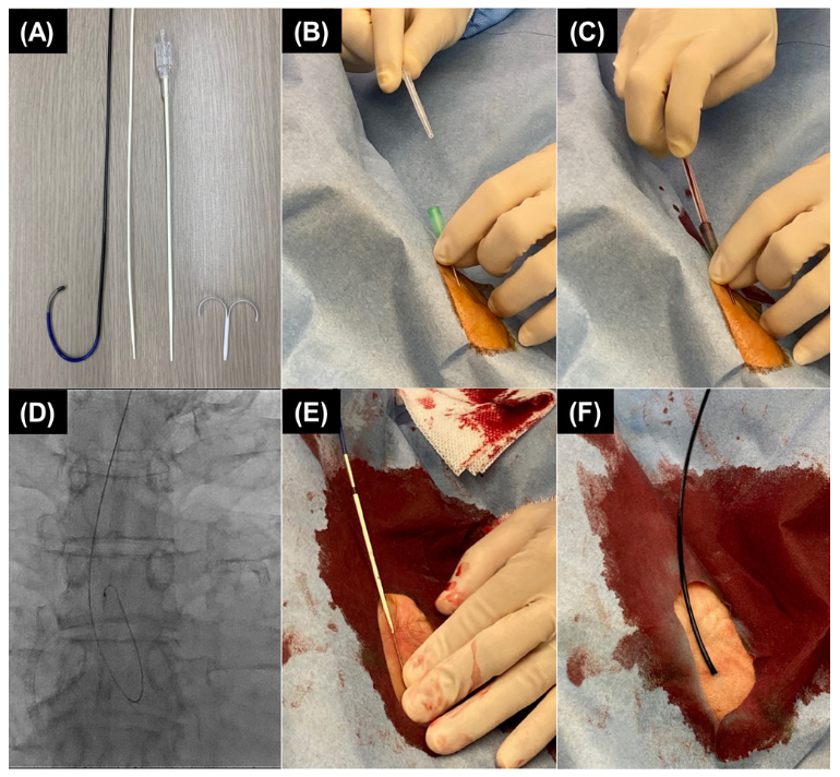 Isawa Hyperion SheathLess Figure 2