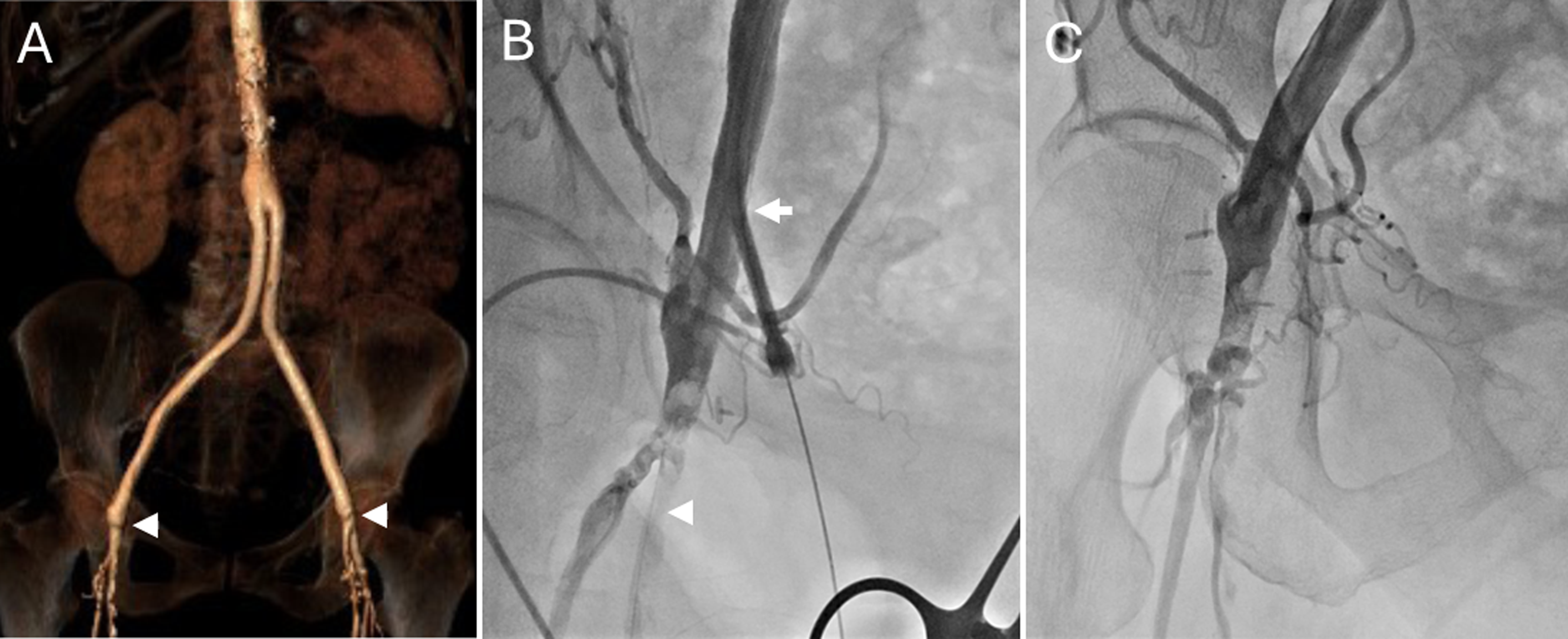 Figure 3. Case 3: A 64-year-old woman with end-stage renal failure