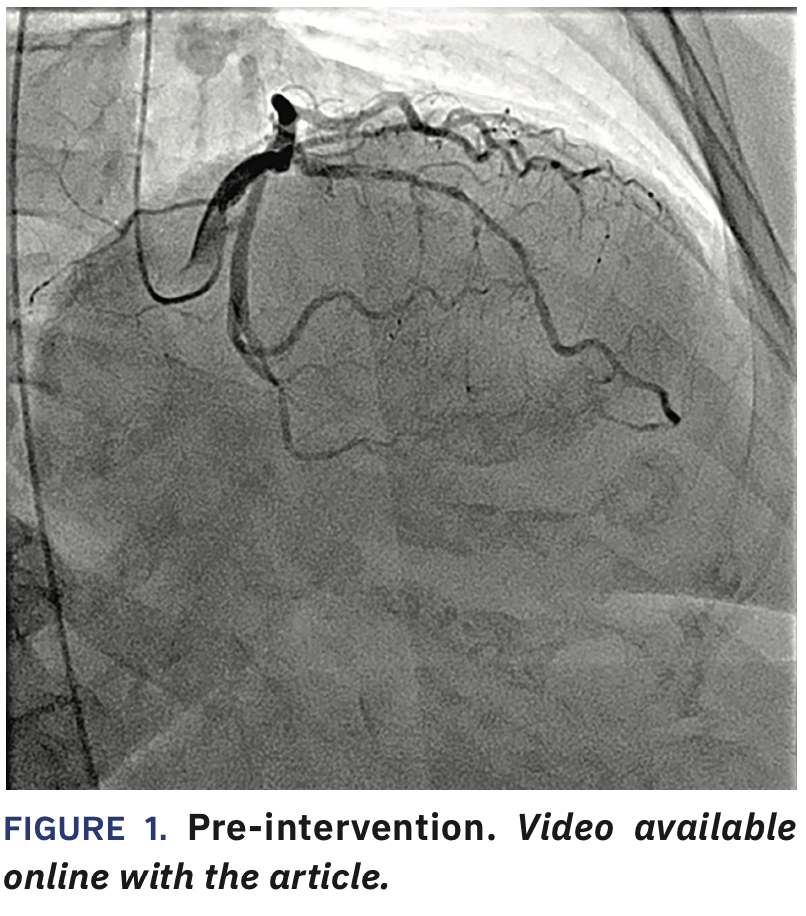 Jauhar North Shore University Hospital case Figure 1