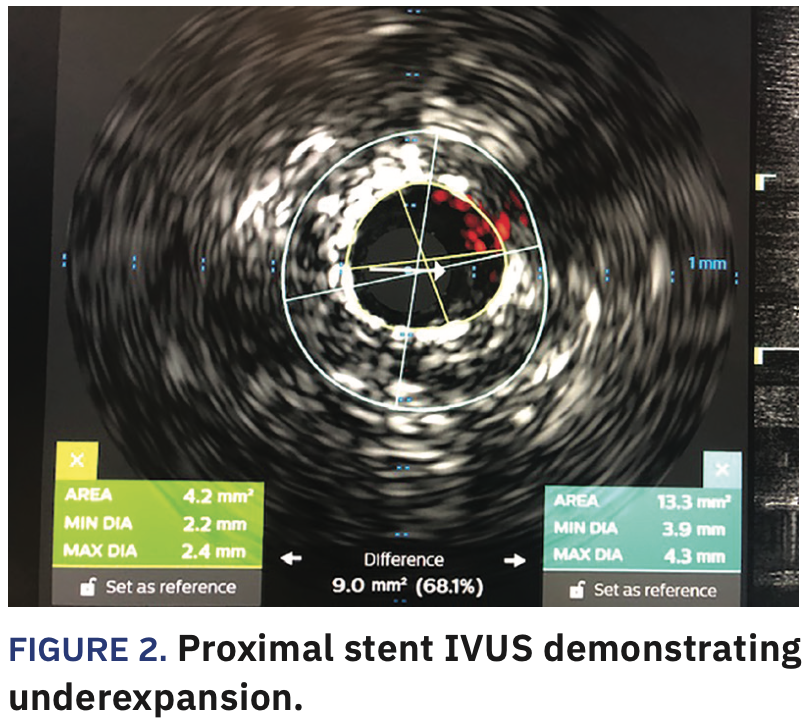 Jauhar North Shore University Hospital case Figure 2
