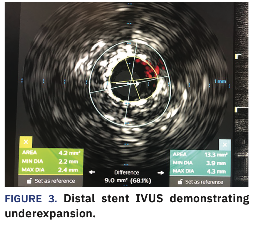 Jauhar North Shore University Hospital case Figure 3