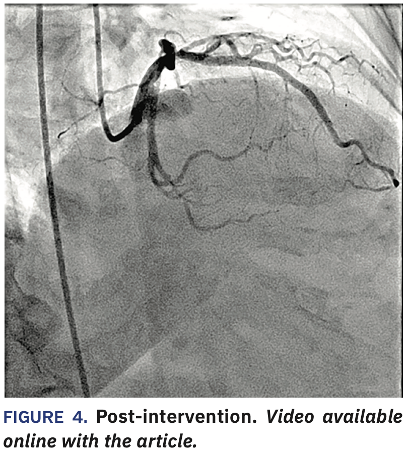 Jauhar North Shore University Hospital case Figure 4