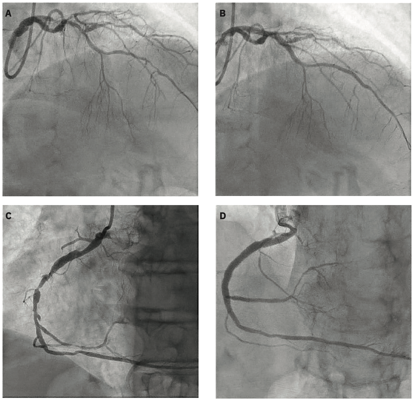 Jefferson Shockwave Figure 1