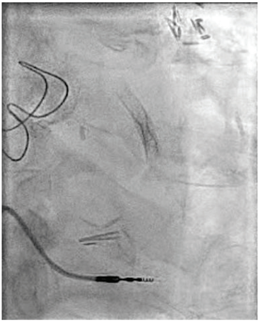 Jefferson-Fig1-CLD-SeptOct 2026.png 
