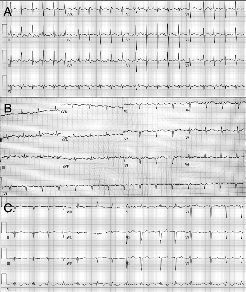 Johnson-Fig1-June2024