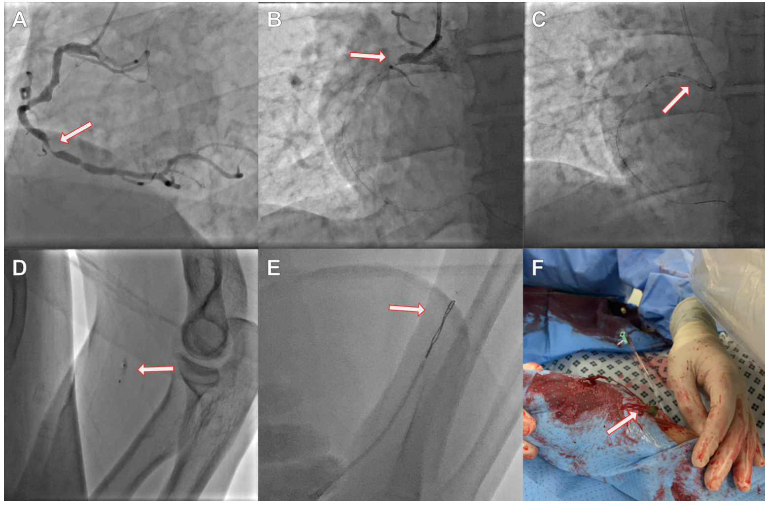Kaier GooseNeck Snare Figure 1