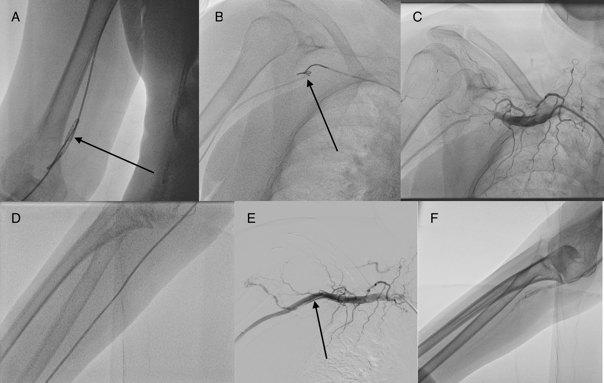 Figure.  Fluoroscopy 