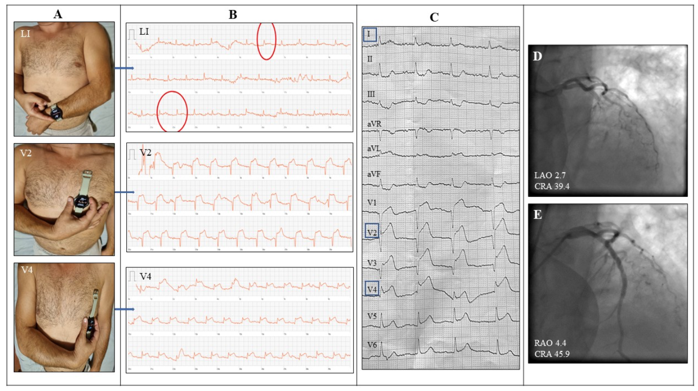 Karelas Smartwatch Figure 1