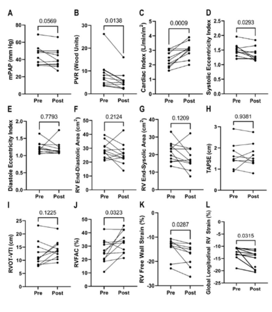 Kazmirczak Angioplasty Figure 1