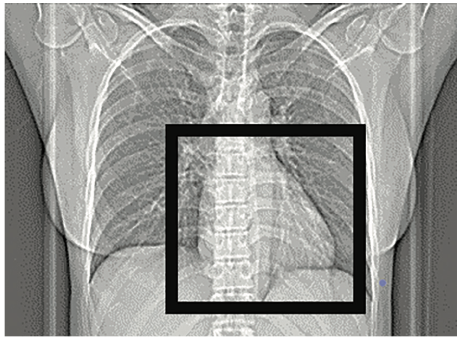 Keimer-Merschen Coronary Artery Disease Figure 2