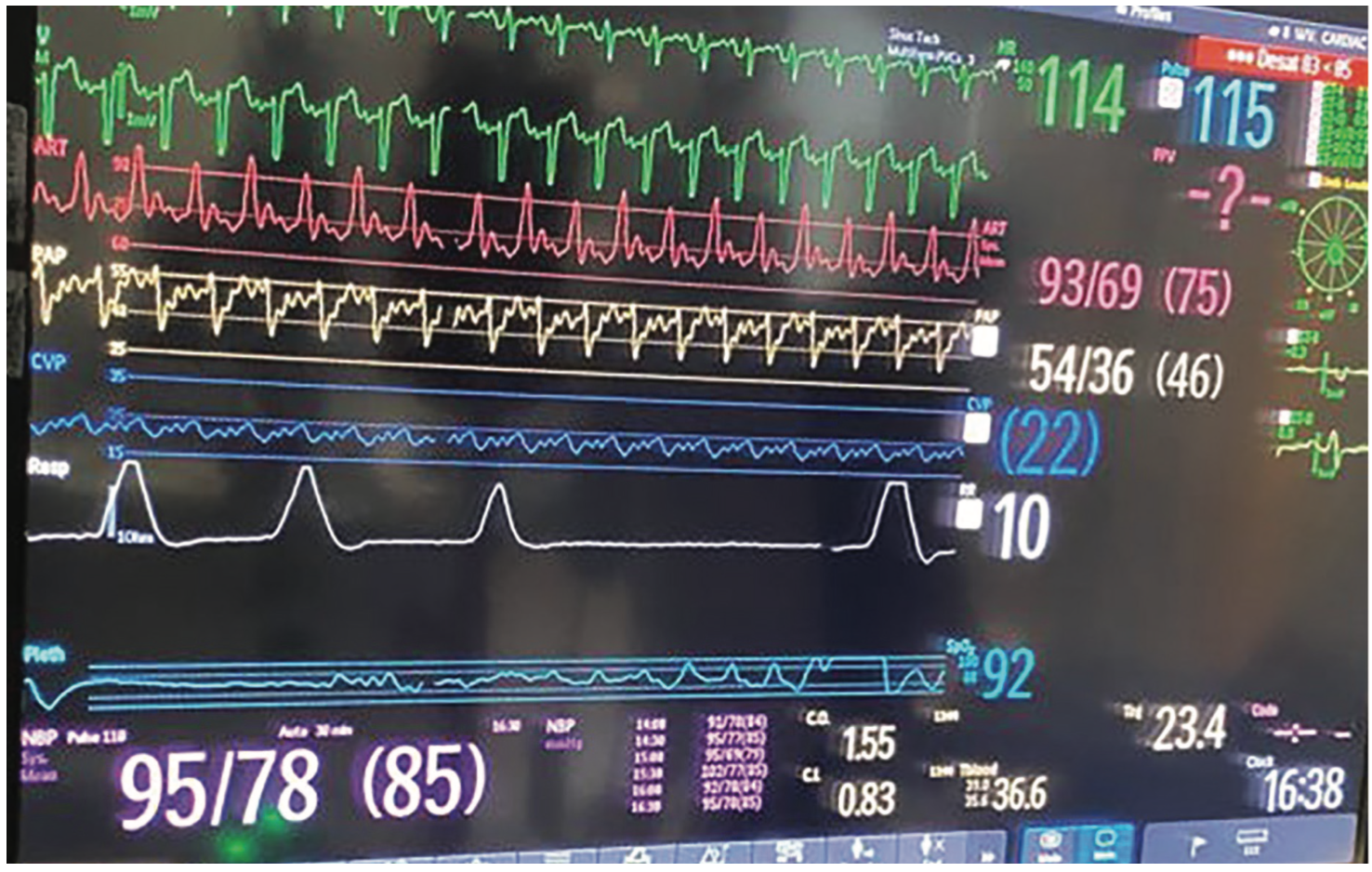 KellyAraj Heart Failure Figure 1