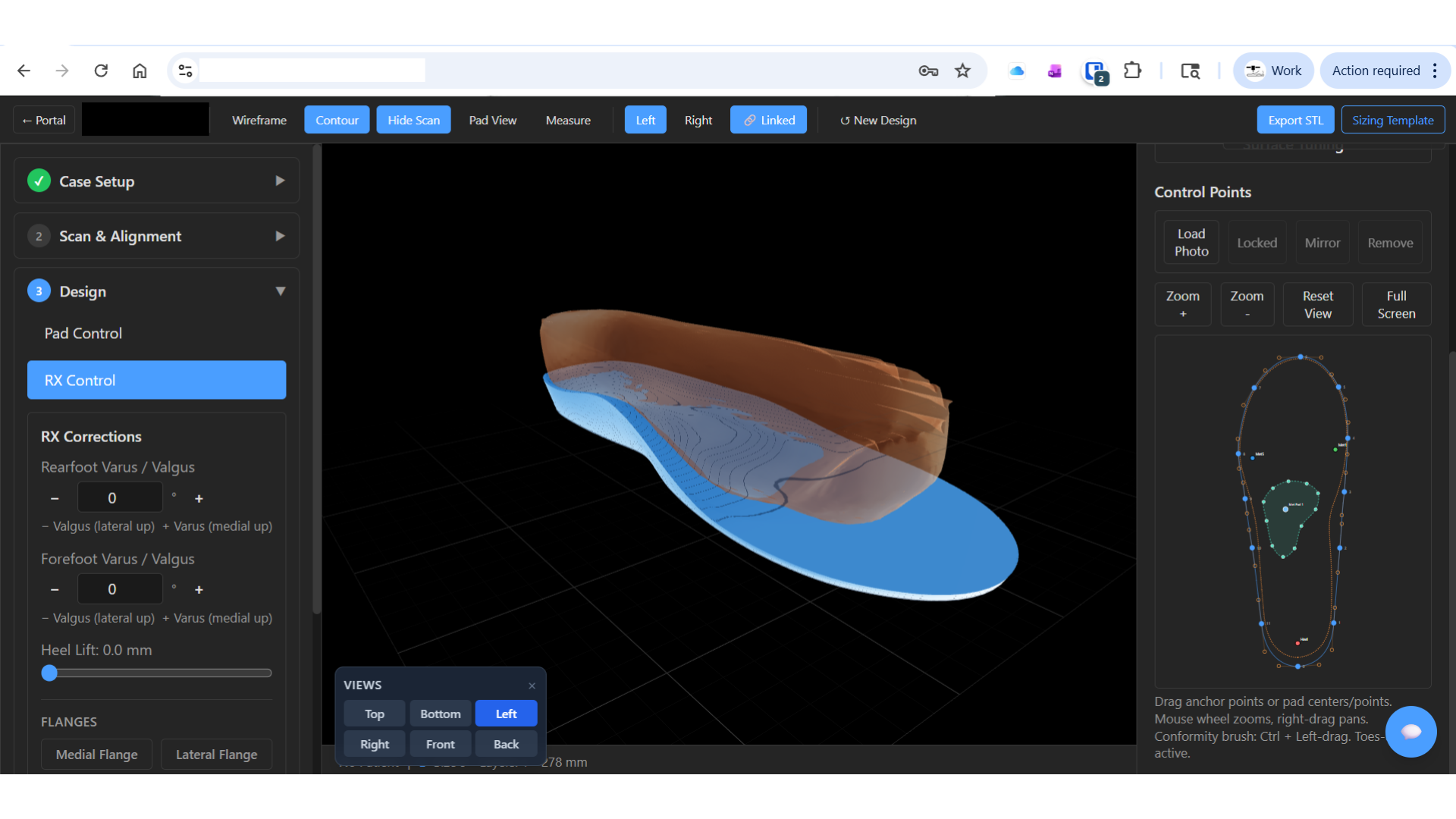 Figure 1: Prescription-driven orthotic CAD workflow showing scan alignment, posting controls, and digital shell modification.   What makes digital manufacturing particularly interesting is the ability to iterate rapidly. Traditionally, even small orthotic modifications may require shipping devices back to a lab, rewriting prescriptions, or waiting through another production cycle. With integrated digital workflows, modifications can potentially be adjusted directly within the design environment and reproduced much more efficiently. 