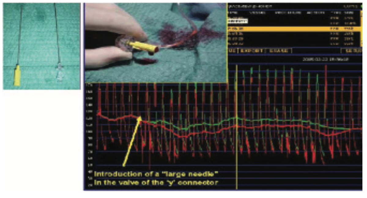 Kern Accurate FFR Figure 1