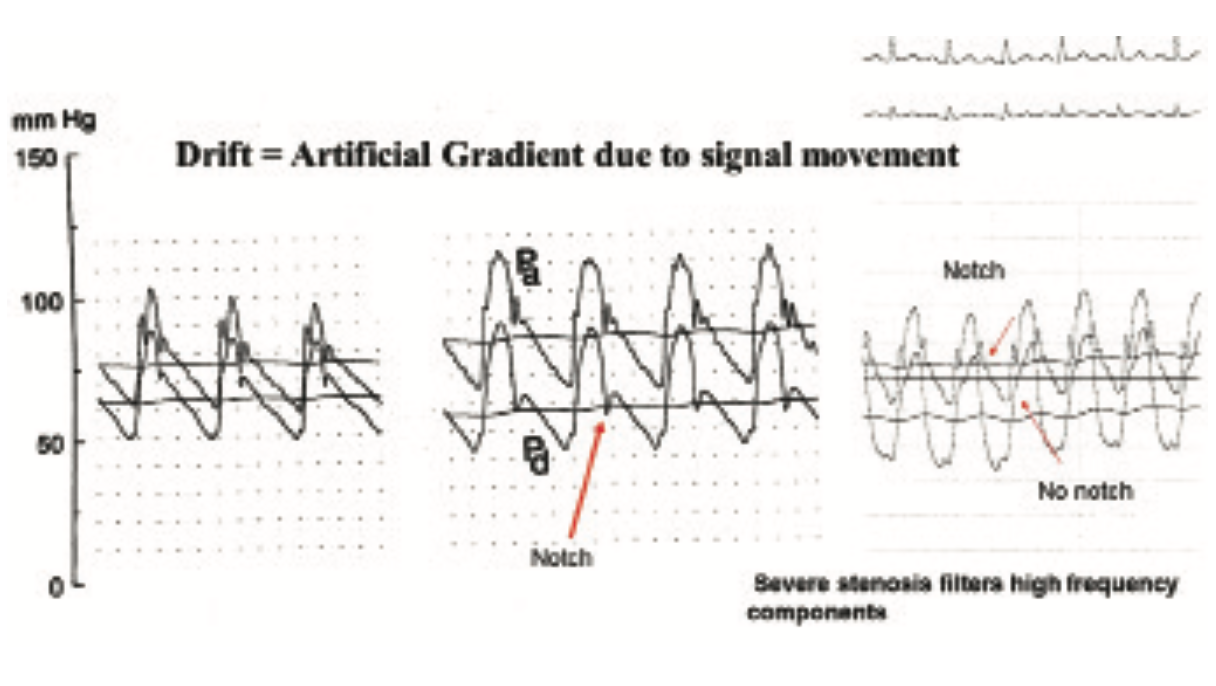 Kern Accurate FFR Figure 2