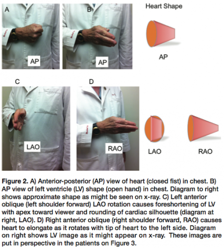 Kern Angiographic Projections_Figure 2