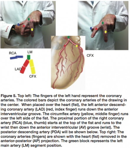Kern Angiographic Projections_Figure 5