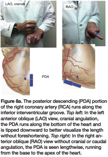 Kern Angiographic Projections_Figure 8a