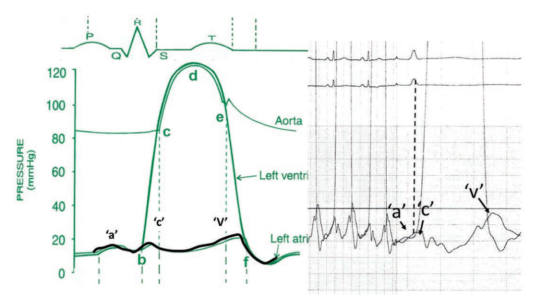 Kern CLD Figure 3