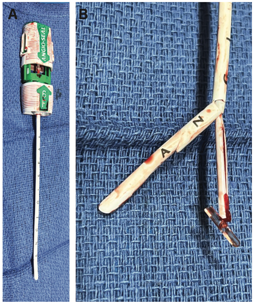 Kern Femoral Hemostasis Figure 2