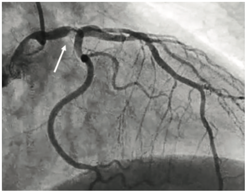 Kern Hemodynamics Figure 1
